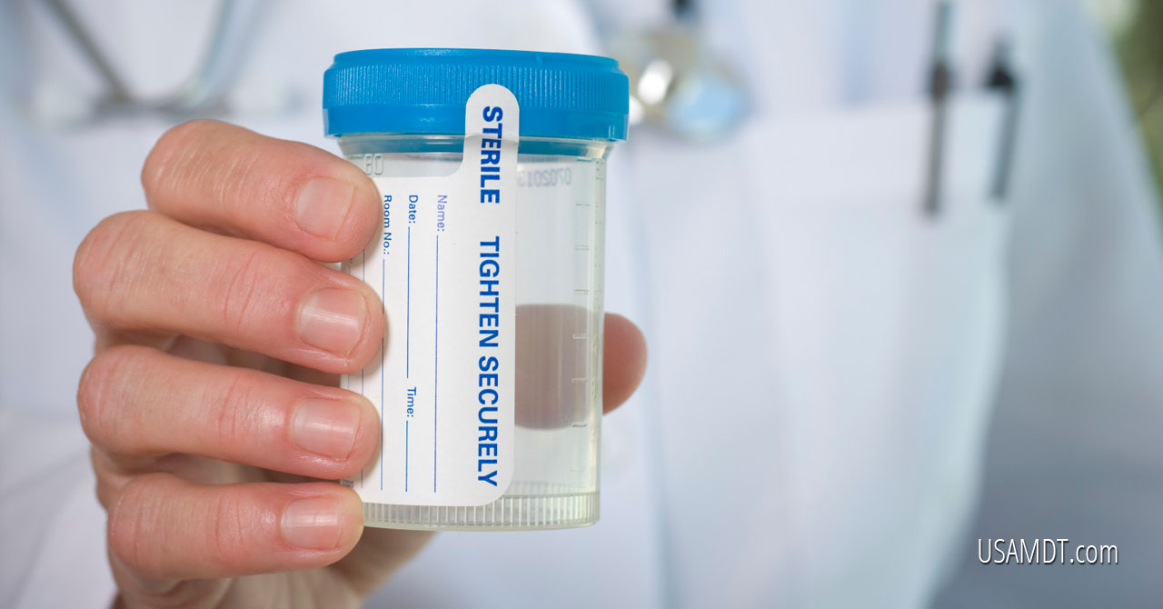 What Are the Standard Types of Drug Testing?