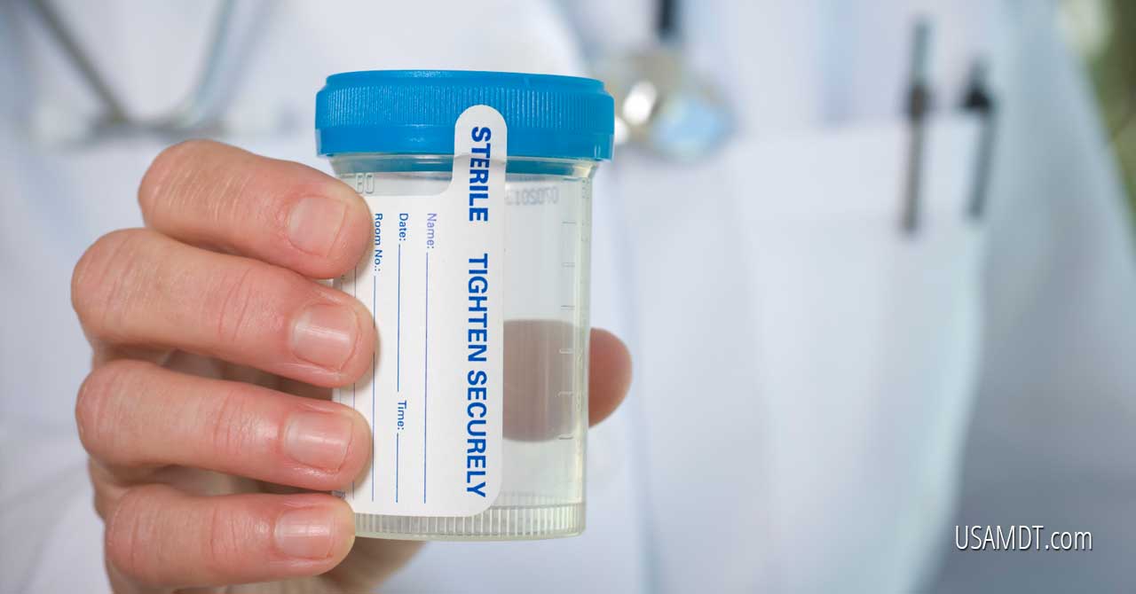 What is Mobile Drug Testing?