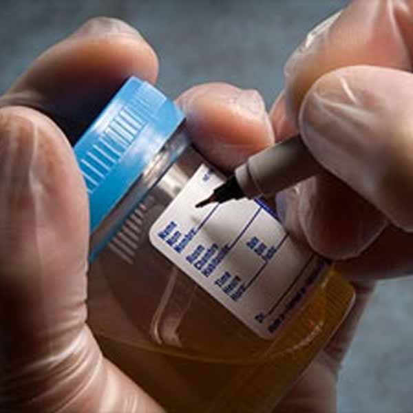 Mobile vs. Off-Site Drug Testing