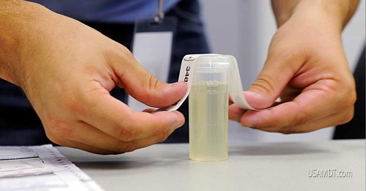 No, Drug Testing Is Not a Violation of Your Rights