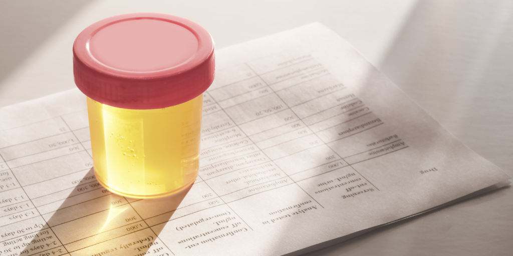 Urine drug testing is the most popular collection method as it is a widely accepted method to test for recent drug use. Urine testing is great for maintaining a drug free workplace, as well as testing on a pre-employment, random, post-accident, or reasonable suspicion basis. Urine testing can be used to identify a wide range of illegal and prescription drugs, too.