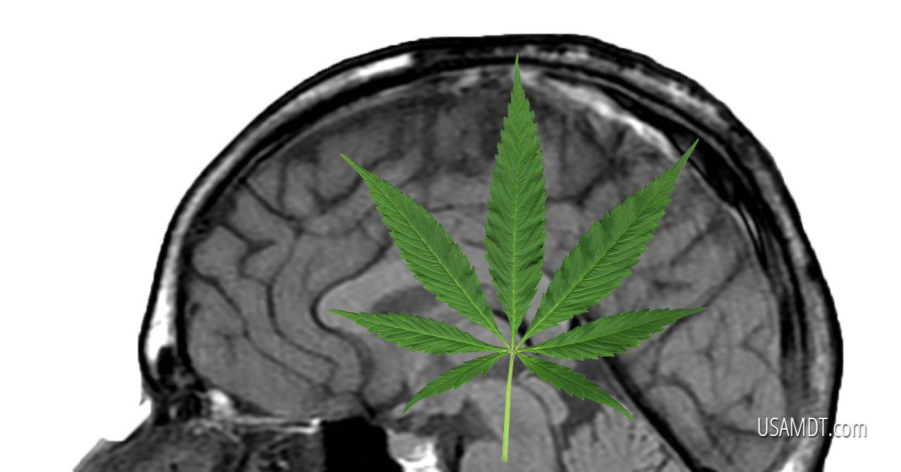 How Does Marijuana Really Affect Your Brain?