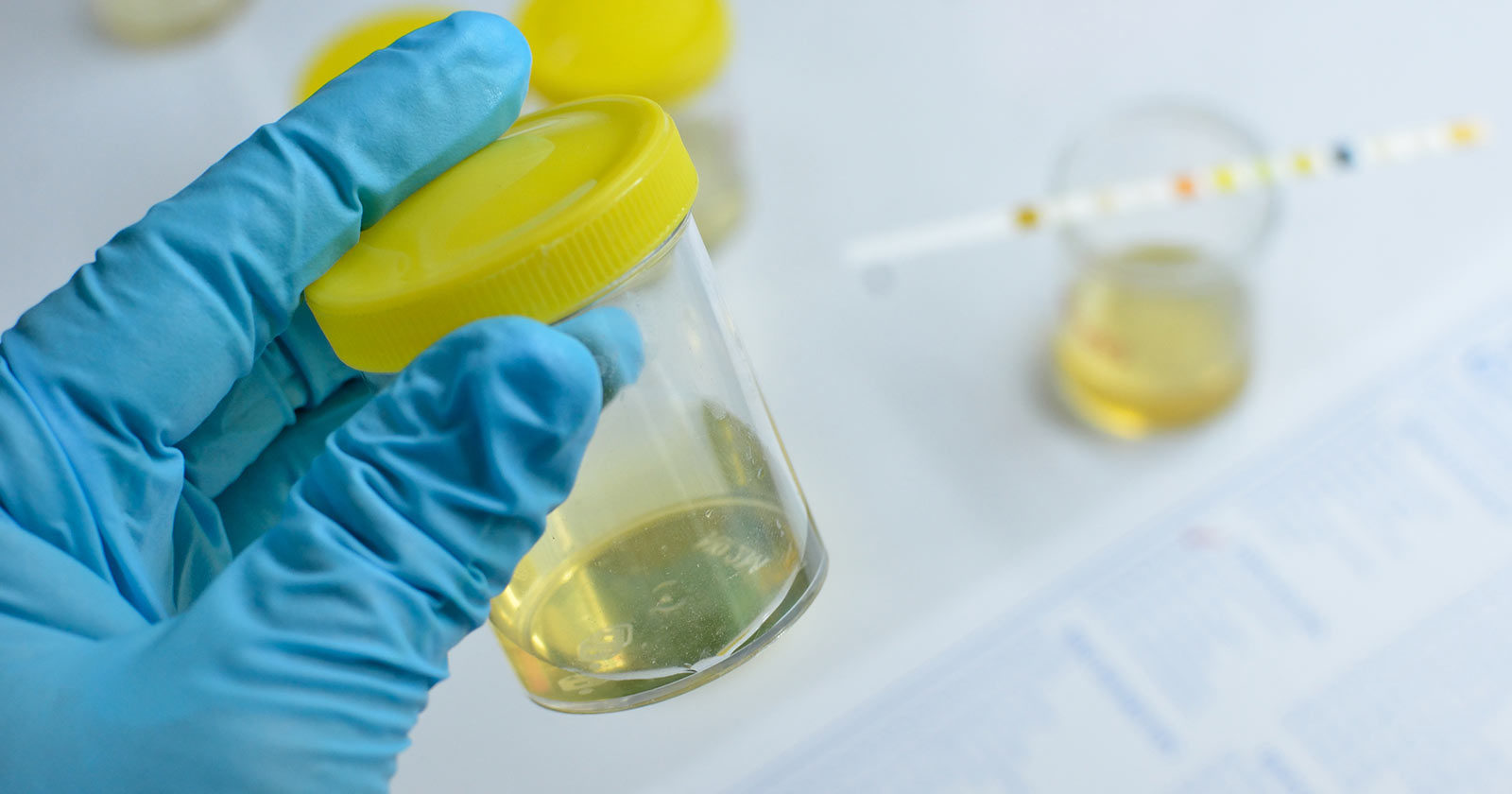 why urine tests may not get the job done