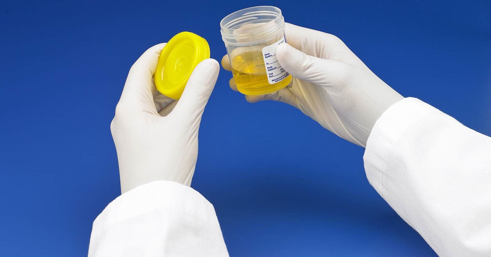 how does urinalysis drug testing work
