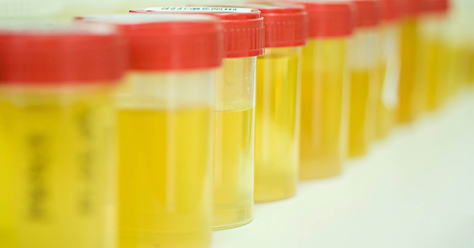 will-oral-fluid-drug-testing-overtake-urine-tests